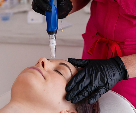 Microneedling@1x